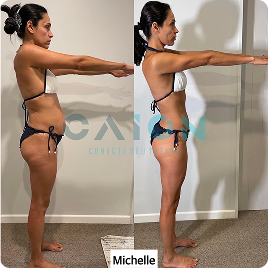 Michelle 1
